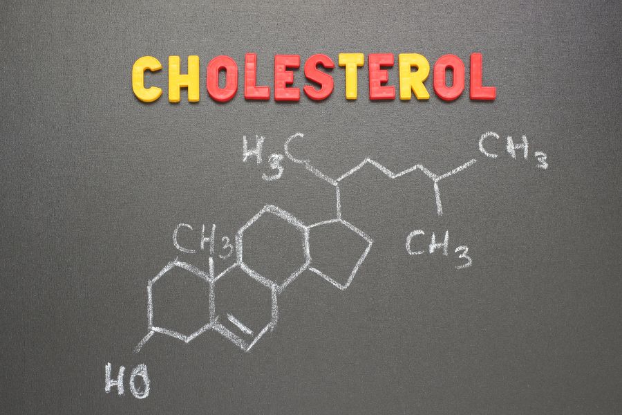 1- Keep a Check on Your Cholesterol Levels